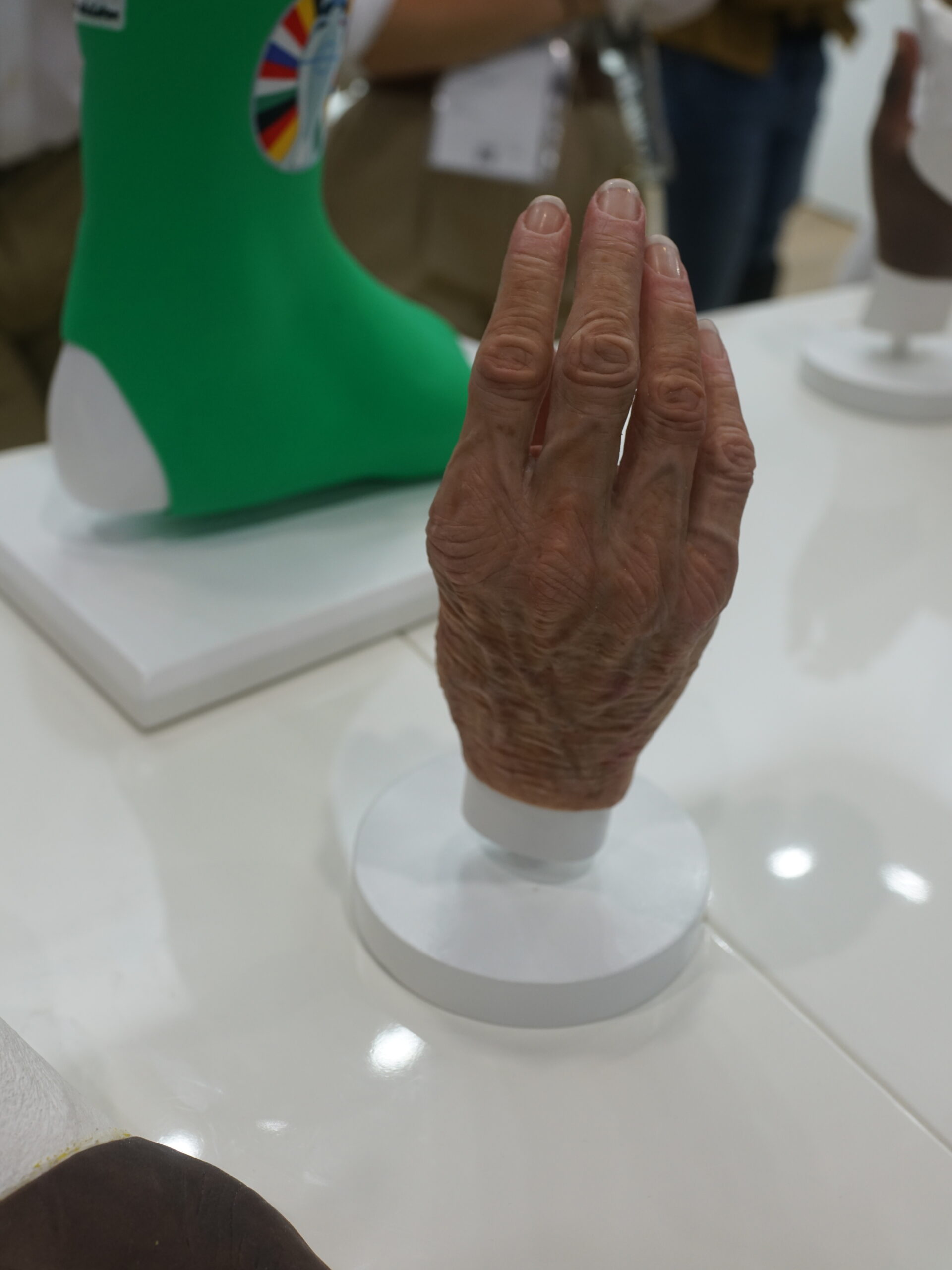 Lifelike Prosthetics