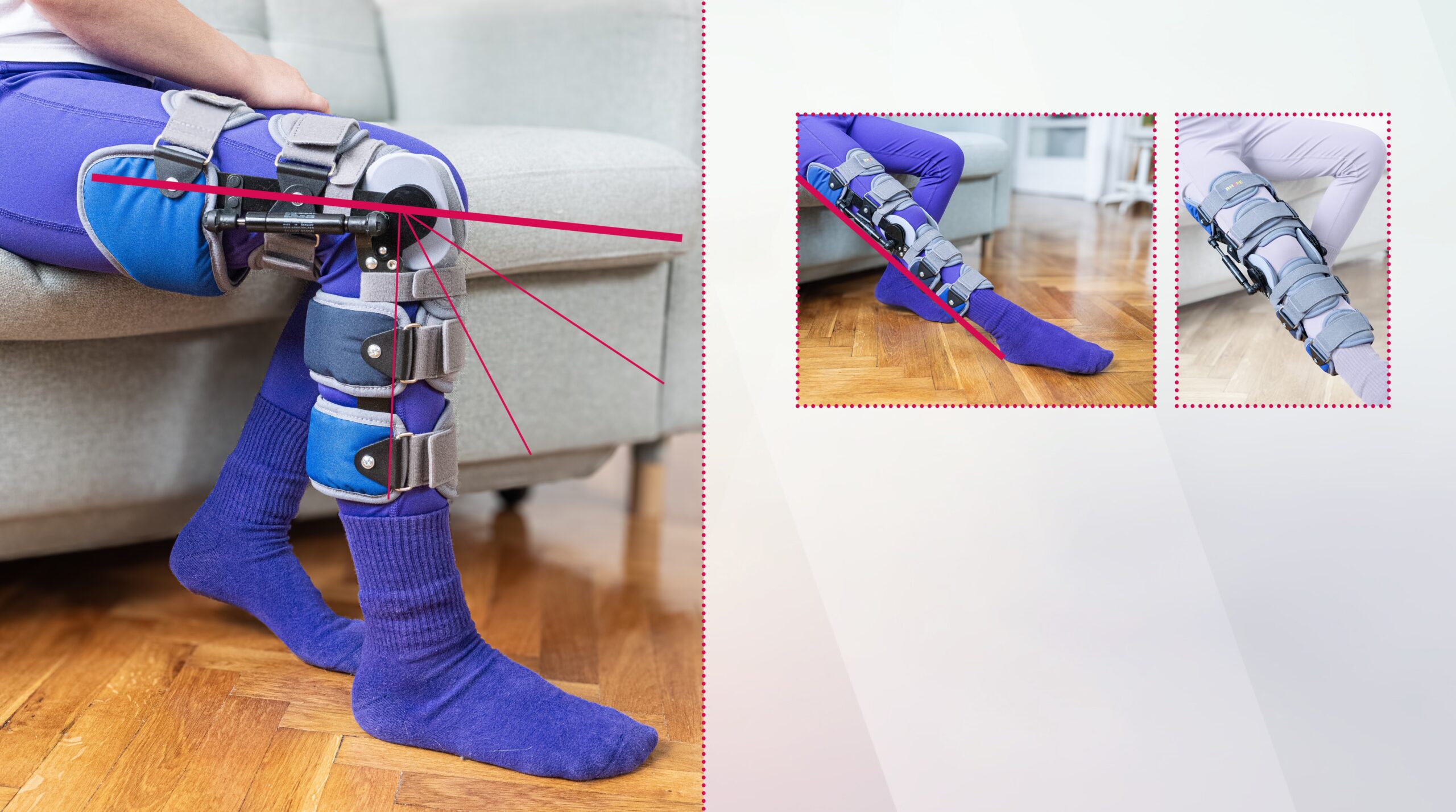 Dynamic extense, Aparat na goleń i udo redersujący staw kolanowy