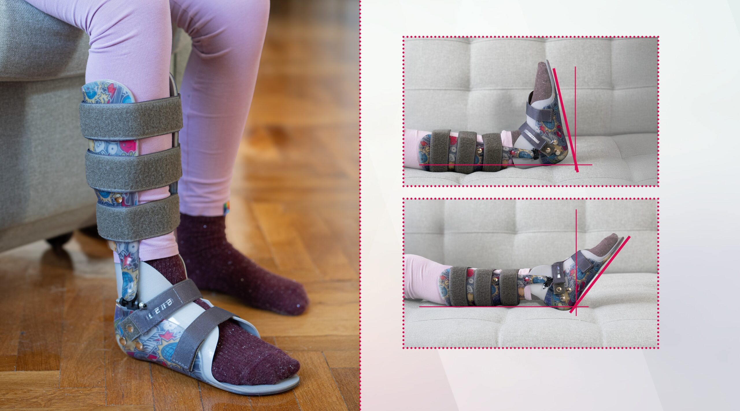 AFO active MAXI, Orteza obejmująca goleń i stopę AFO Joint Plus