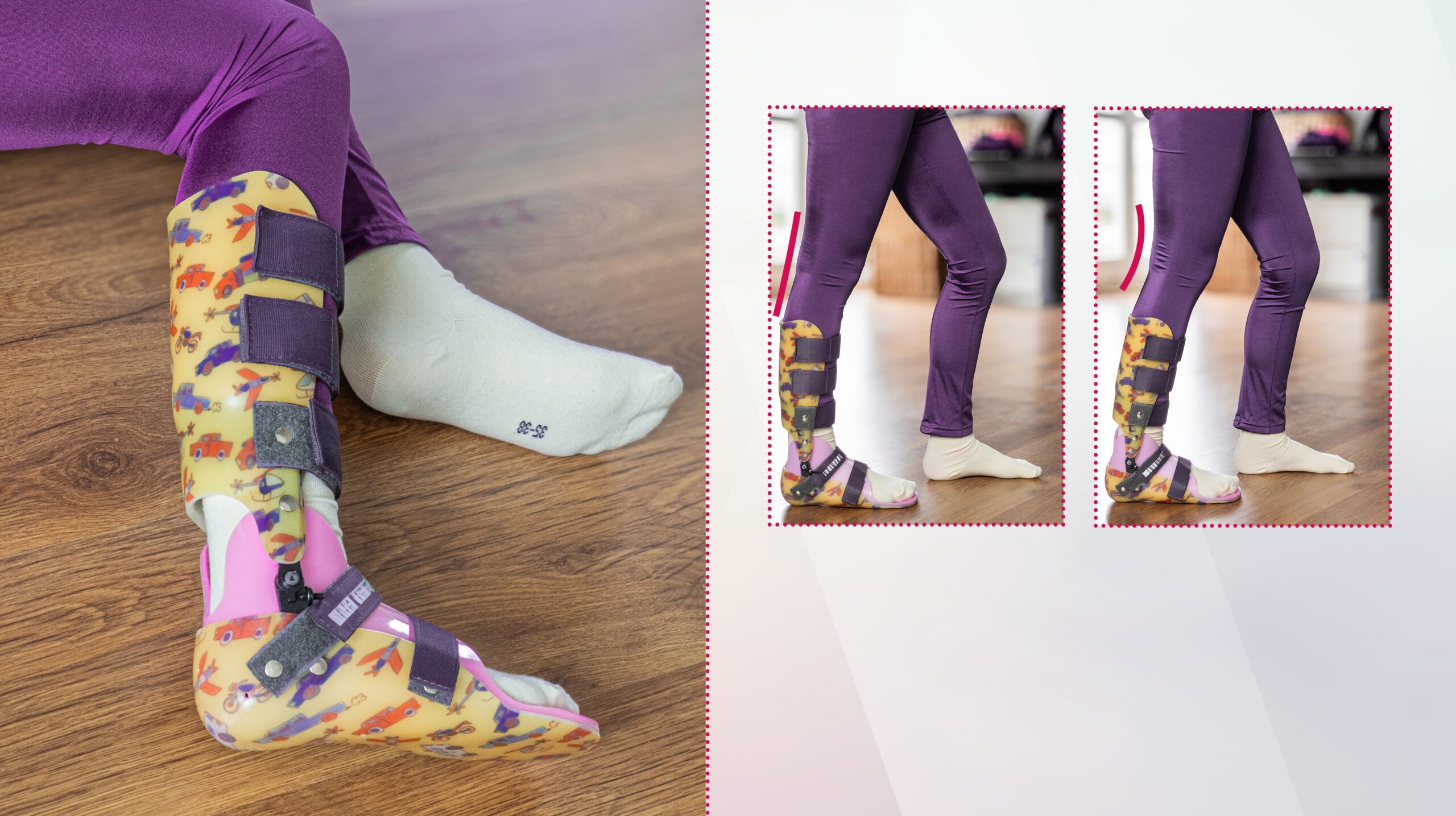 AFO Active MINI, Orteza obejmująca goleń i stopę AFO Joint Plus