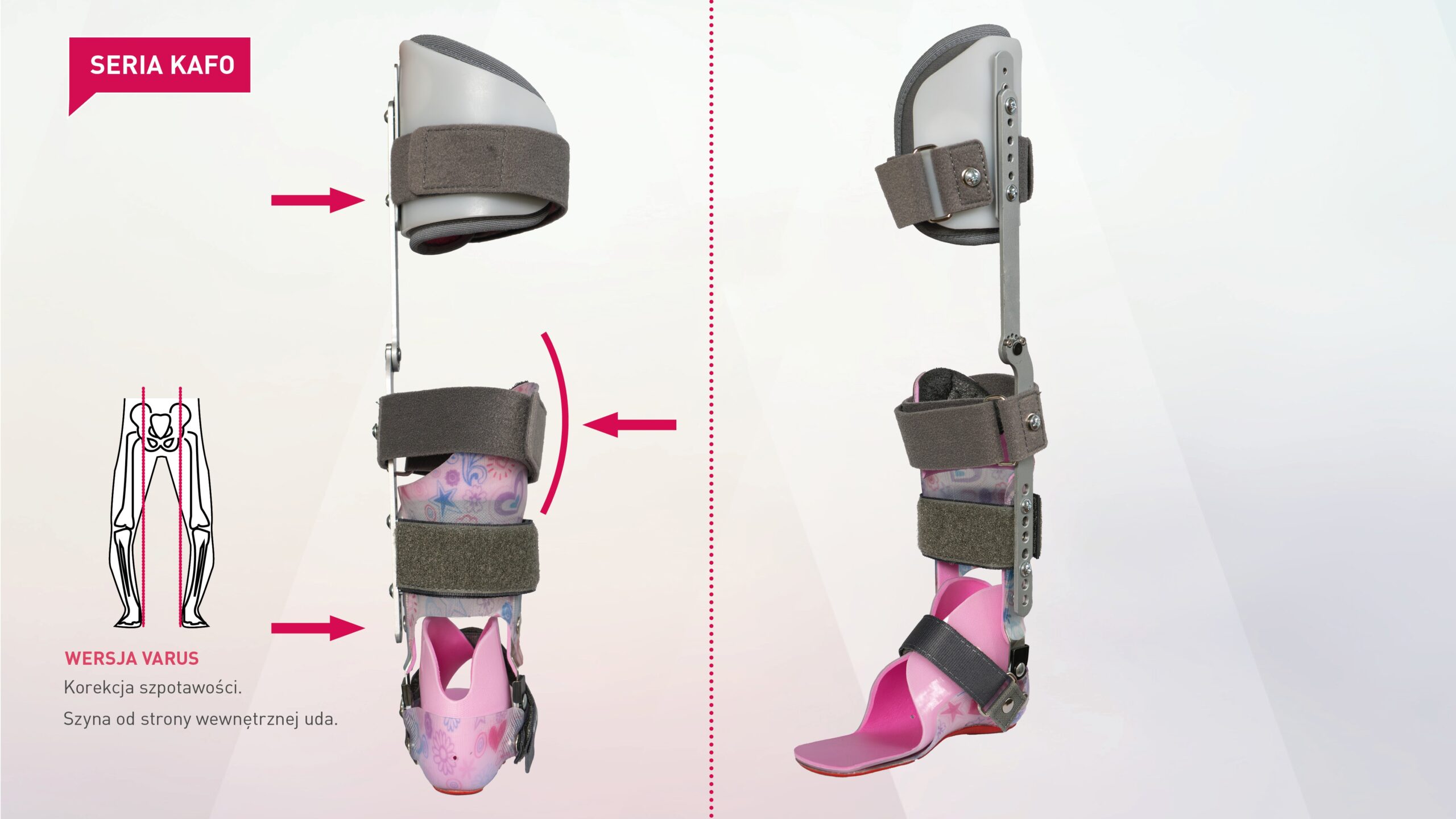 Orteza z ujęciem uda goleni i stopy KAFO Joint Plus.  Varus Dynamic Correktion
